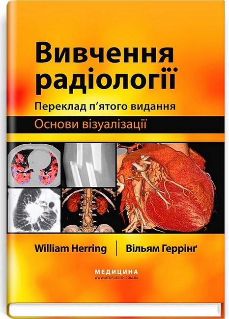 Вивчення радіології Основи візуалізації 5-е видання Авт: Вільям Геррінґ Вид-во: Медицина - фото 1