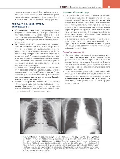 Вивчення радіології Основи візуалізації 5-е видання Авт: Вільям Геррінґ Вид-во: Медицина - фото 4