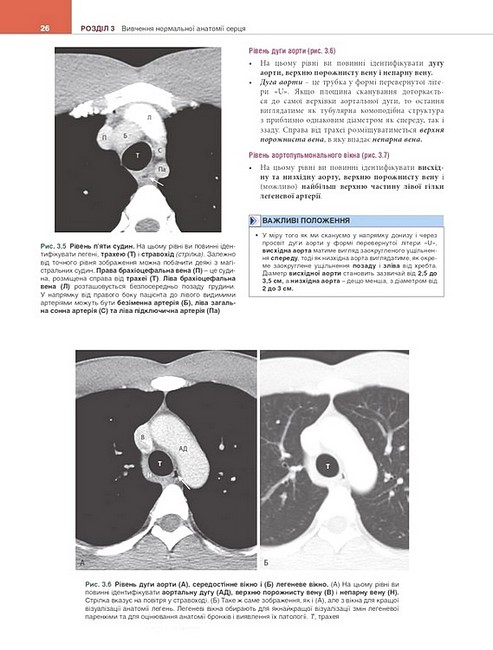 Вивчення радіології Основи візуалізації 5-е видання Авт: Вільям Геррінґ Вид-во: Медицина - фото 5