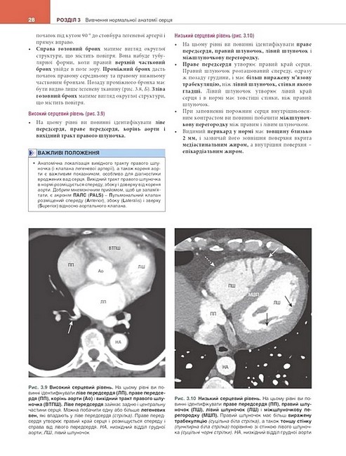 Вивчення радіології Основи візуалізації 5-е видання Авт: Вільям Геррінґ Вид-во: Медицина - фото 7