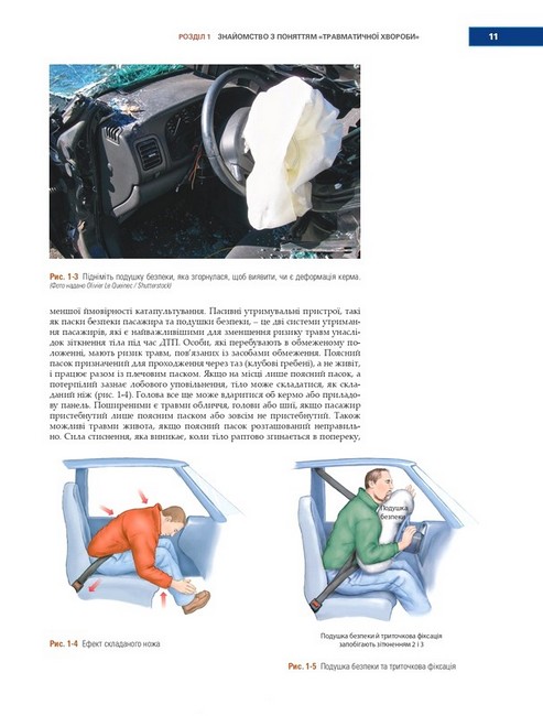 Догоспітальна допомога при травмах. 9-е видання - фото 5