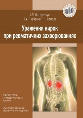 Ураження нирок при ревматичних захворюваннях Ураження нирок при ревматичних захворюваннях